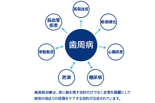 全身疾患と深く関わる歯周病